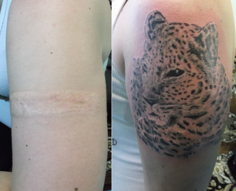 Перекрытие татуировок и шрамов